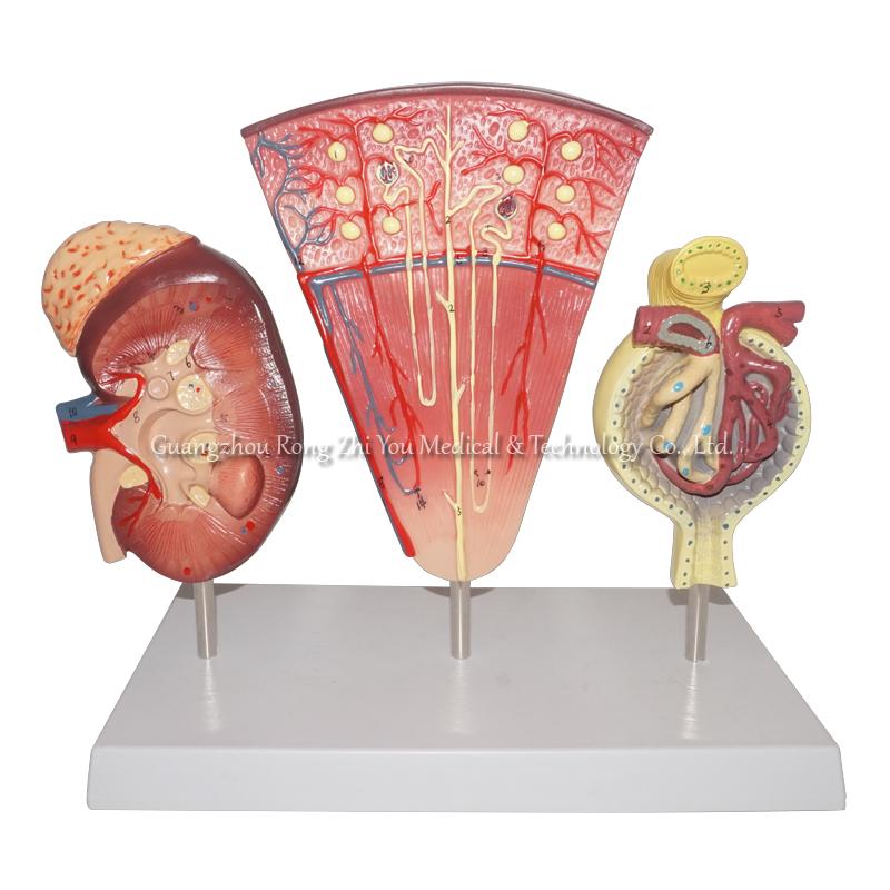  Kidney Model