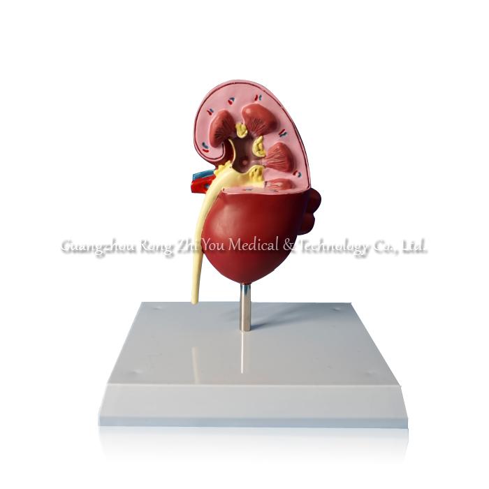 Plastic Kidney Model