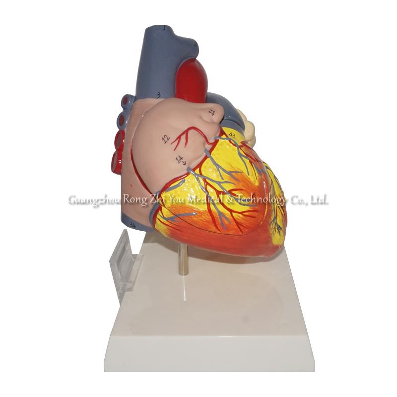 Middle Heart Model