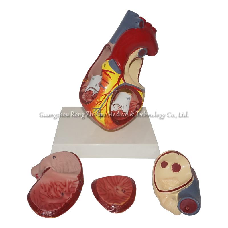 Middle Heart Model
