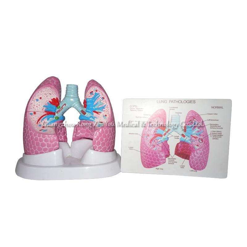 Lung Structure Anatomical Model