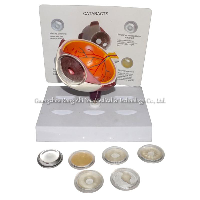Eye Cornea Anatomical Model