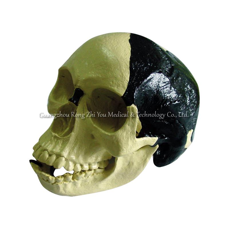 Berto man skull