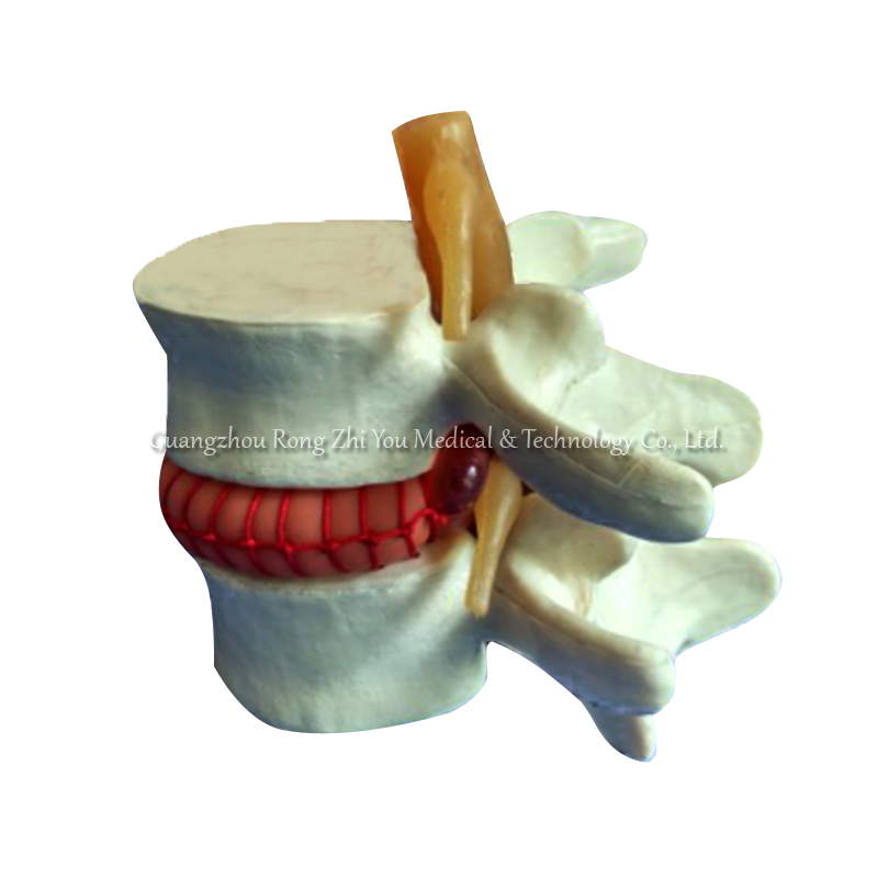 Vertebral Simulator Model