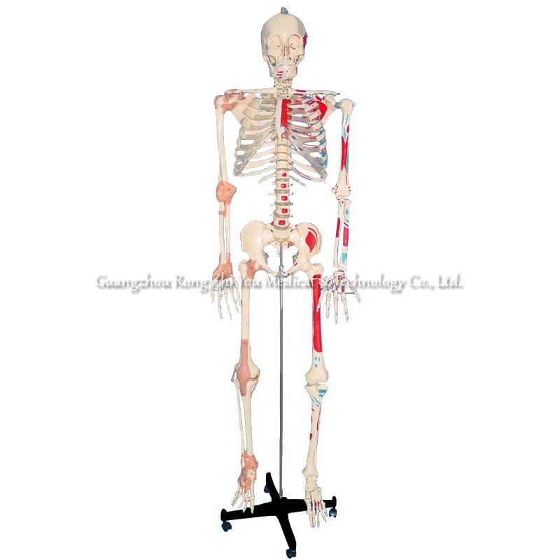 Skeleton Model With Ligament And Muscle