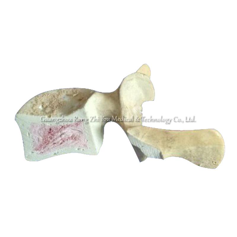 Orthopedic Surgery Practice vertebra Bone Orthopedic Surgery Practice vertebra Bone