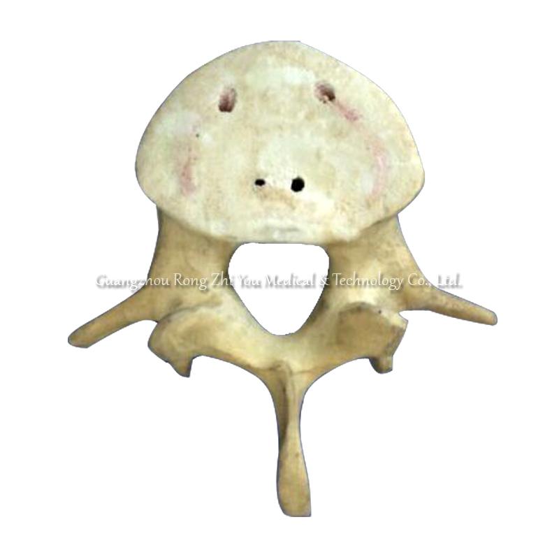 Orthopedic Surgery Practice vertebra Bone Orthopedic Surgery Practice vertebra Bone