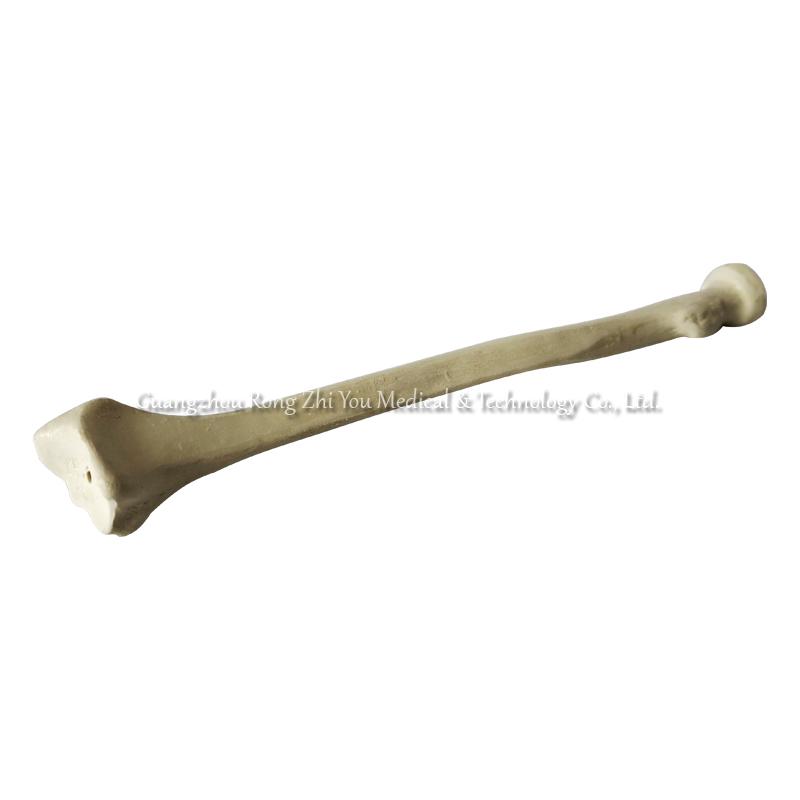 Surgery Practice Bone Radius Surgery Practice Bone Radius