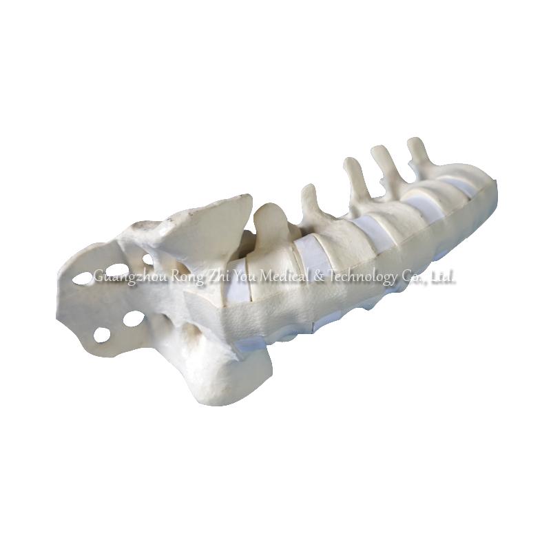 Lumbar Spine Anatomy Model