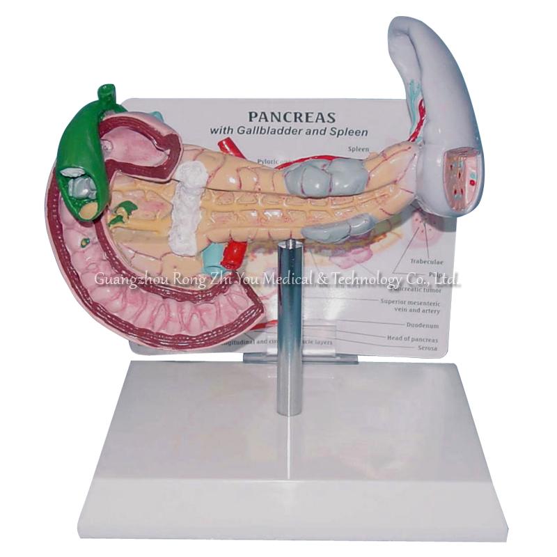 Pathological Model of Pancreas, Duodenum and Spleen