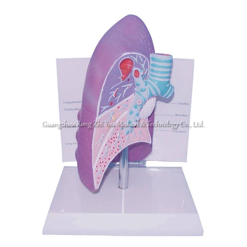 Pathologies Human Lung