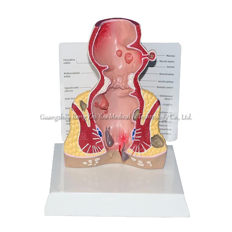 Rectum Anatomical Model