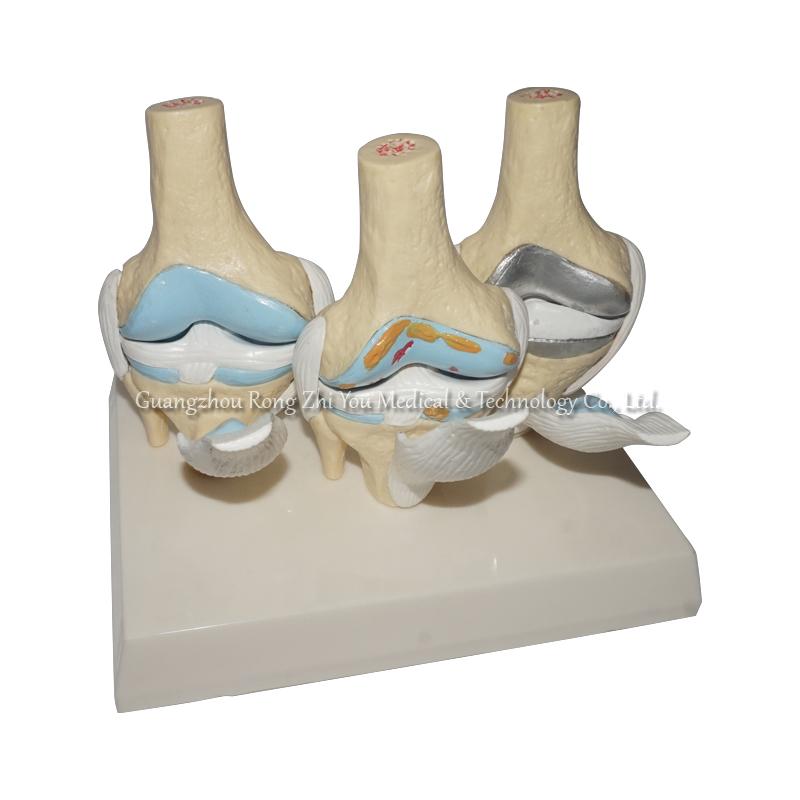 Human Knee Joints Model