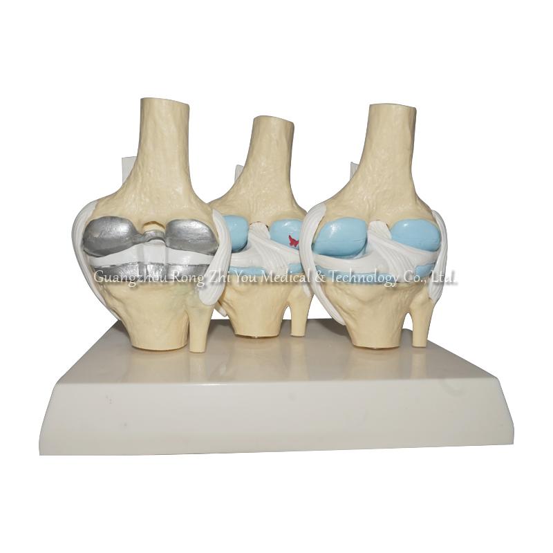 Human Knee Joints Model