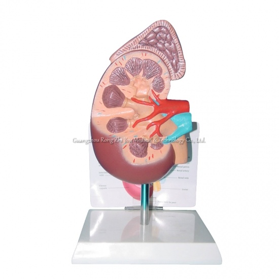 Human Kidney Model