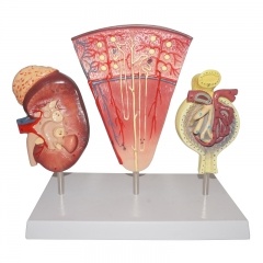  Kidney Model