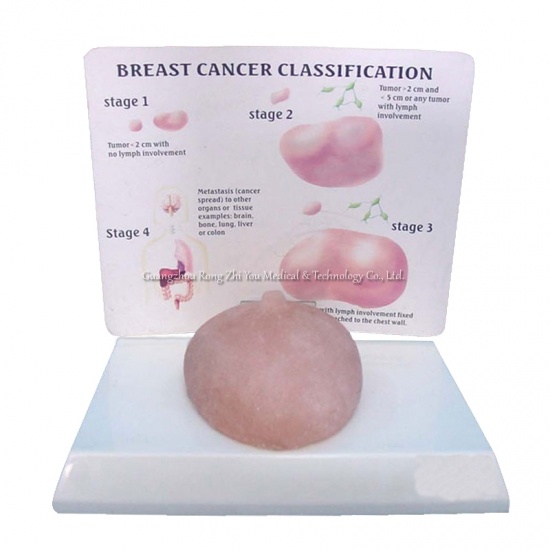 Human Breast Model