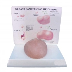 Human Breast Model