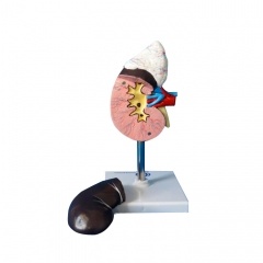 Human Kidney Model