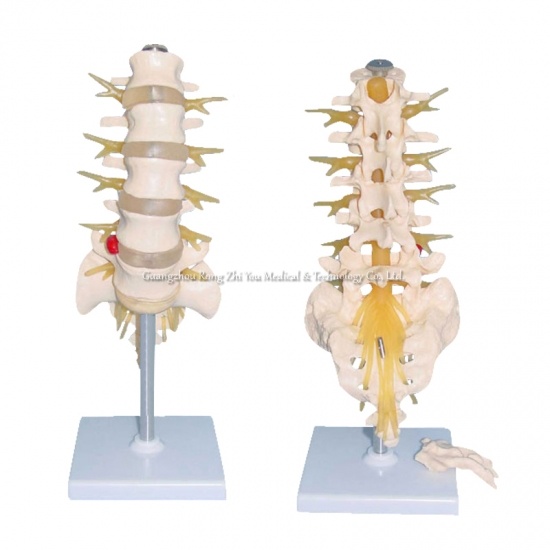 Lumbar Vertebra Model