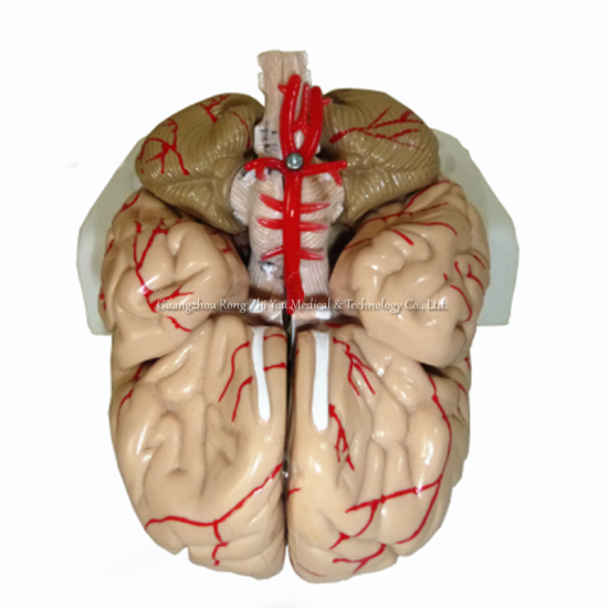 3D brain model