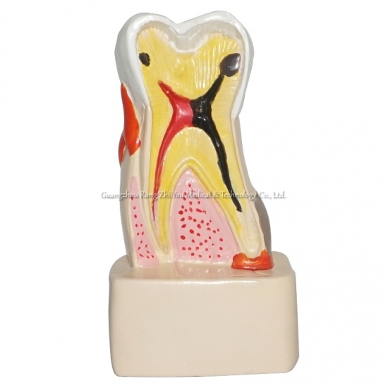 Pathology Dental Model