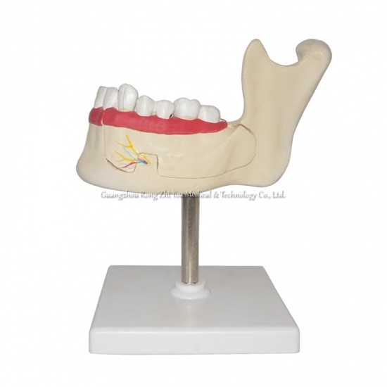 Teeth and Jaw Model