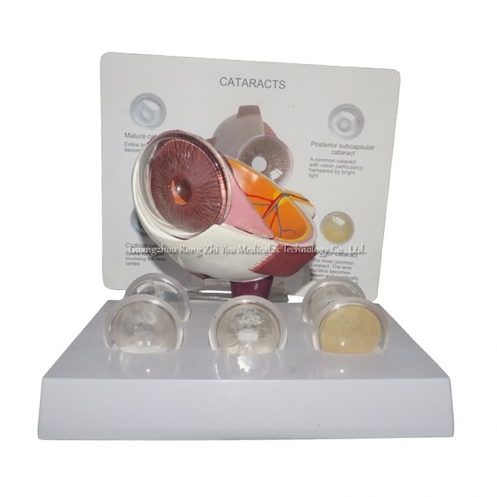 Eye Cornea Anatomical Model
