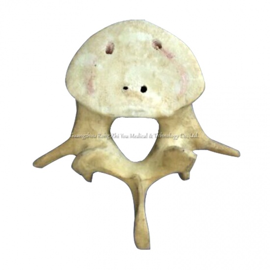Orthopedic Surgery Practice vertebra Bone