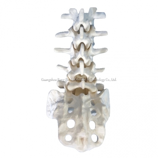 Lumbar Spine  Anatomy Model
