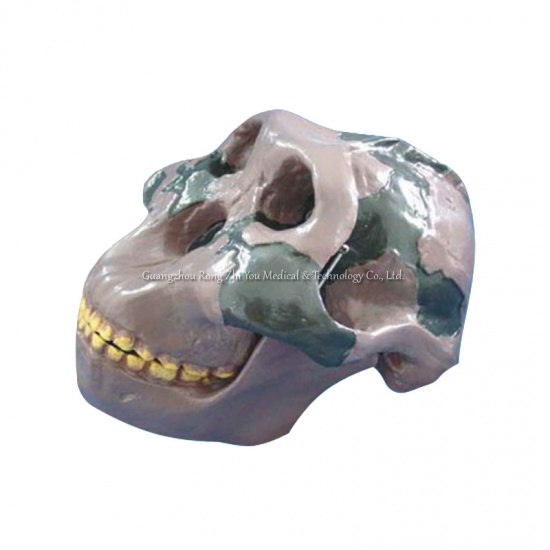 Medical Teaching Human Skull