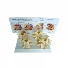 Vertebrae Nomorl Diseaser Composition