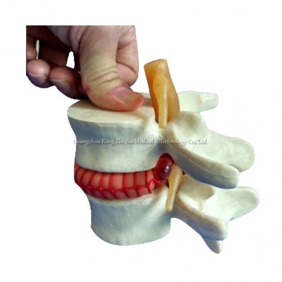 Vertebral Simulator Model