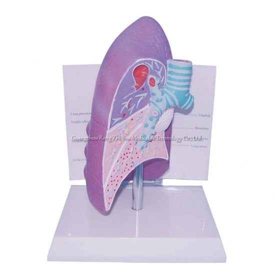 Pathologies Human Lung