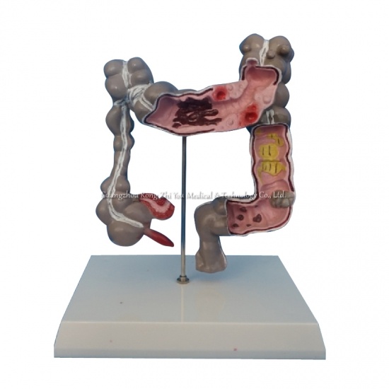 Colon Anatomical Model