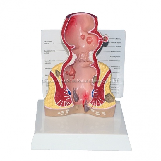 Rectum Anatomical Model