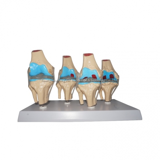 Knee Joint Structure Model