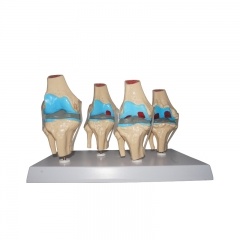 Knee Joint Structure Model