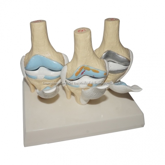 Human Knee Joints Model