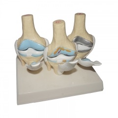 Human Knee Joints Model