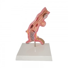 Esophageal Disease Model
