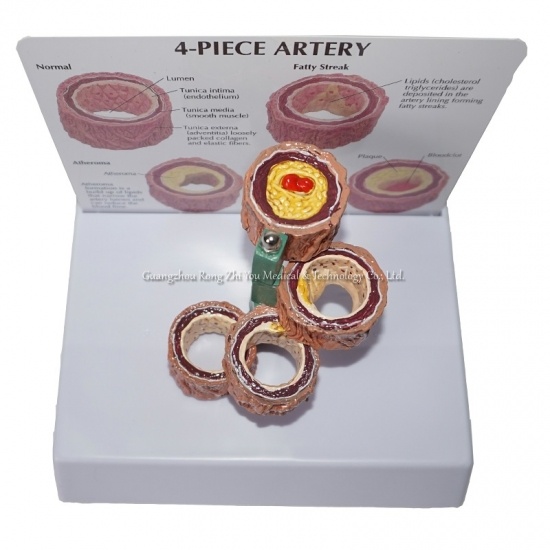 Artery Anatomical Model