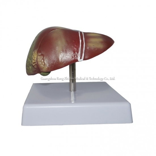 Liver Structure Model