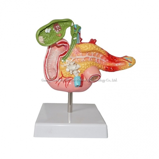 Disease Nephropathy Model