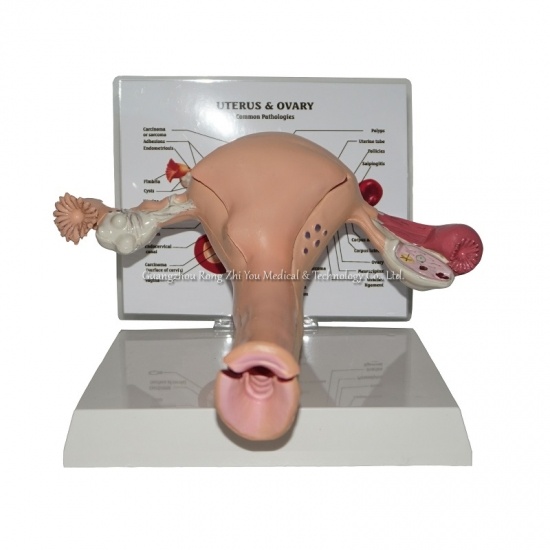 Uterus Model