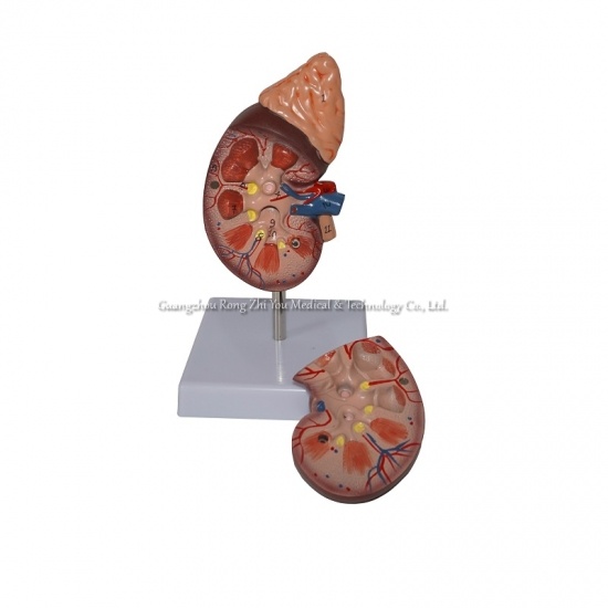 Kidney Model
