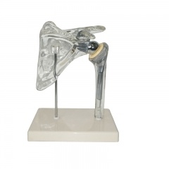 Shoulder Implant Model