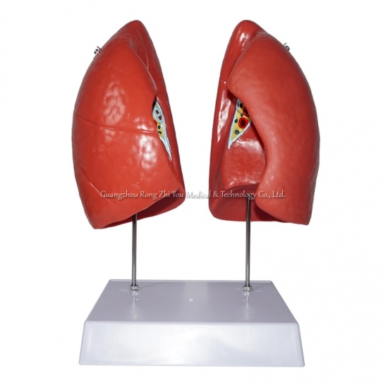 Lung Model