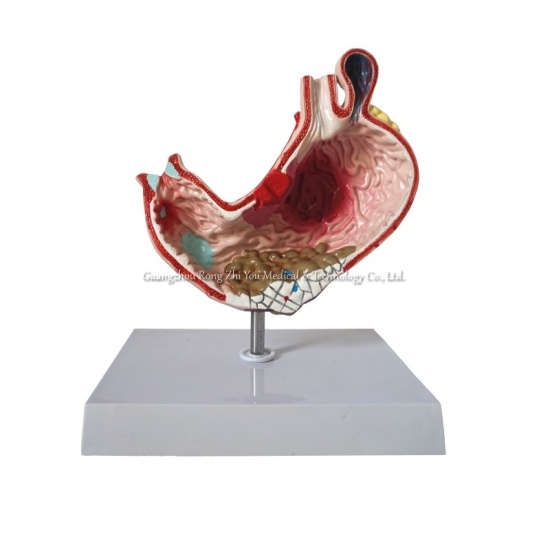 Stomach Anatomical Model