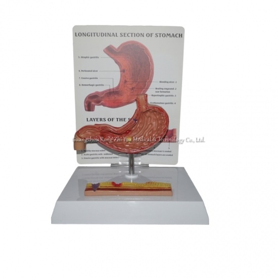 Human Stomach Model